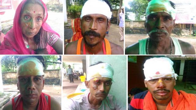 बांका: कांवरियों से भरी जीप के ड्राइवर ने नींद के झोंके में ट्रक में मारी ठोकर, 12 घायल